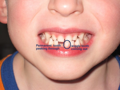 labeled teeth